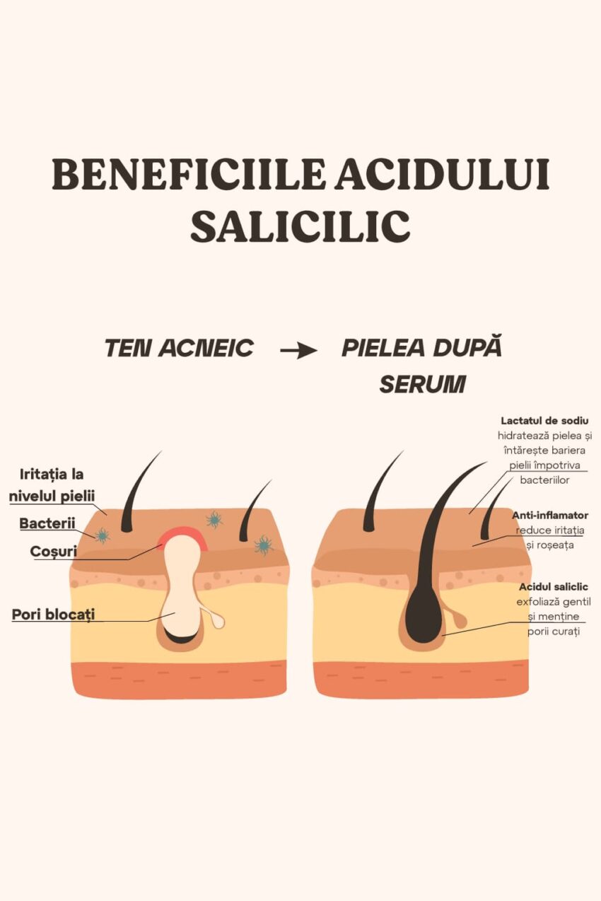 Acid Saliclic 2